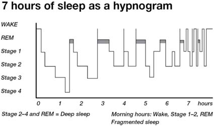 hypno